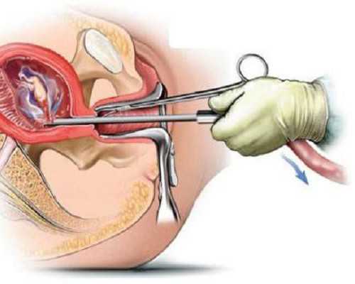 关于试管婴儿的这三个谣言，你听过几个？
